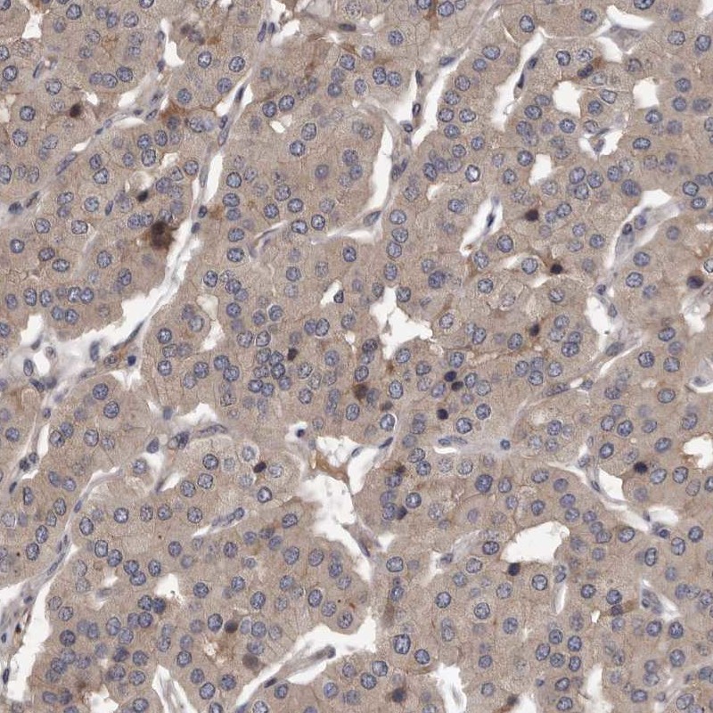 Anti-PRKD1 Antibody