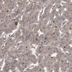 Anti-PRKD1 Antibody