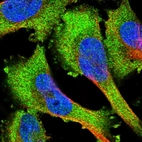 Immunofluorescent staining of human cell line U-251 MG shows localization to plasma membrane & cytosol.