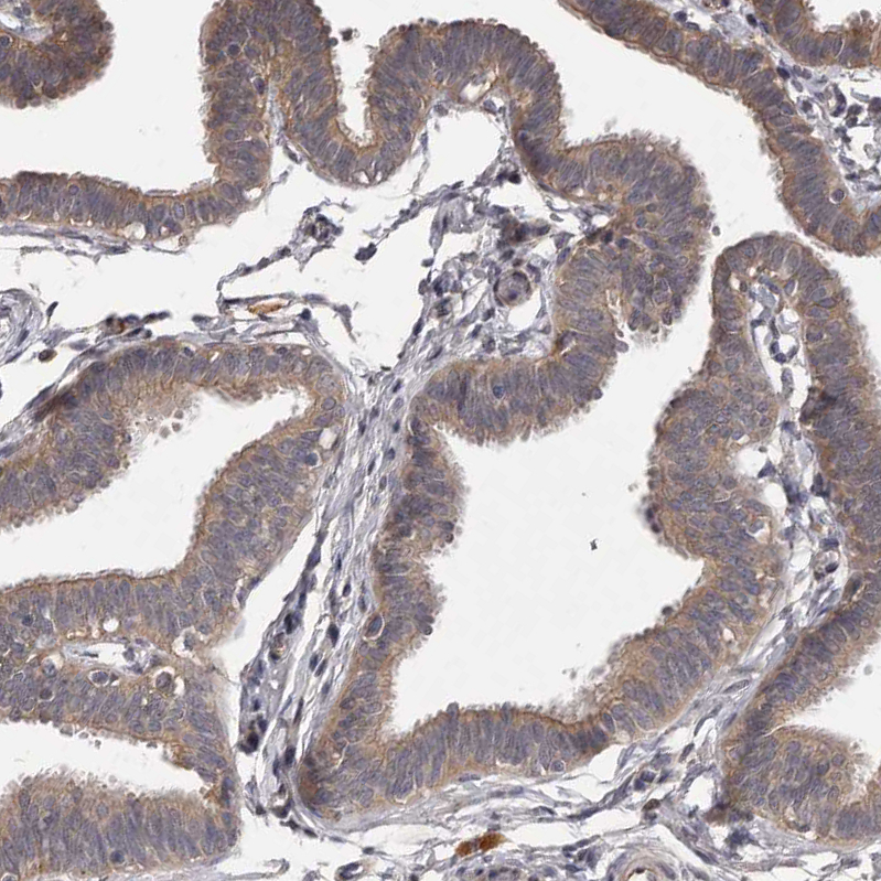 Anti-PNRC1 Antibody
