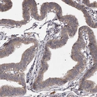 Anti-PNRC1 Antibody