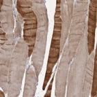 Immunohistochemical staining of human skeletal muscle shows moderate to strong cytoplasmic positivity in myocytes.