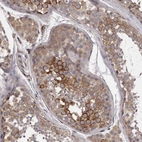 Immunohistochemical staining of human testis shows moderate to strong cytoplasmic positivity in cells in seminiferous ducts.