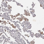 Immunohistochemical staining of human lung shows weak to moderate cytoplasmic positivity in macrophages.