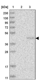 Anti-PNRC1 Antibody