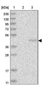Lane 1: Marker [kDa] 230, 130, 95, 72, 56, 36, 28, 17, 11_br/_Lane 2: Human cell line RT-4_br/_Lane 3: Human cell line U-251MG sp