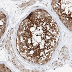 Immunohistochemical staining of human testis shows strong cytoplasmic positivity in cells in seminiferous ducts.