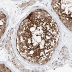 Immunohistochemical staining of human testis shows strong cytoplasmic positivity in cells in seminiferous ducts.