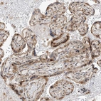 Immunohistochemical staining of human placenta shows weak cytoplasmic positivity in trophoblastic cells.