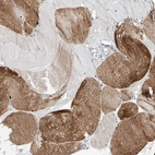 Immunohistochemical staining of human skeletal muscle shows weak cytoplasmic positivity in myocytes.