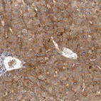 Anti-SLC22A1 Antibody