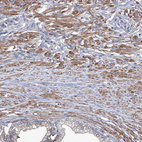 Immunohistochemical staining of human prostate shows moderate cytoplasmic positivity in smooth muscle cells.