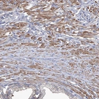 Immunohistochemical staining of human prostate shows moderate cytoplasmic positivity in smooth muscle cells.