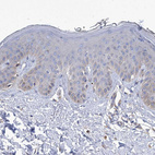 Immunohistochemical staining of human skin shows no positivity in squamous epithelial cells as expected.
