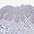 Immunohistochemical staining of human skin shows no positivity in squamous epithelial cells as expected.