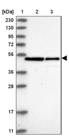 Lane 1: Marker [kDa] 230, 130, 95, 72, 56, 36, 28, 17, 11_br/_Lane 2: Human cell line RT-4_br/_Lane 3: Human cell line U-251MG sp