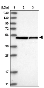 Lane 1: Marker [kDa] 230, 130, 95, 72, 56, 36, 28, 17, 11_br/_Lane 2: Human cell line RT-4_br/_Lane 3: Human cell line U-251MG sp