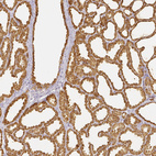 Immunohistochemical staining of human lactating breast shows moderate cytoplasmic positivity in glandular cells.