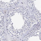 Immunohistochemical staining of human testis shows no positivity in cells in seminiferous ducts as expected.
