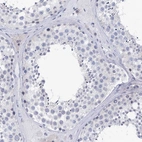 Immunohistochemical staining of human testis shows no positivity in cells in seminiferous ducts as expected.