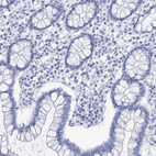 Immunohistochemical staining of human colon shows no positivity in glandular cells as expected.