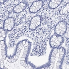 Immunohistochemical staining of human colon shows no positivity in glandular cells as expected.
