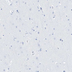 Immunohistochemical staining of human cerebral cortex shows no positivity in neurons as expected.