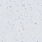 Immunohistochemical staining of human cerebral cortex shows no positivity in neurons as expected.