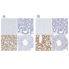 Anti-LALBA Antibody