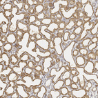 Anti-LALBA Antibody