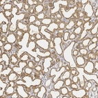 Immunohistochemical staining of human lactating breast shows moderate cytoplasmic positivity in glandular cells.