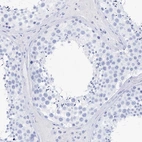 Immunohistochemical staining of human testis shows no positivity in cells in seminiferous ducts as expected.