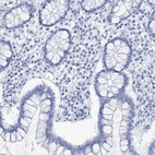 Immunohistochemical staining of human colon shows no positivity in glandular cells as expected.