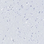 Immunohistochemical staining of human cerebral cortex shows no positivity in neurons as expected.
