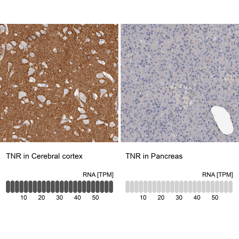 Anti-TNR Antibody