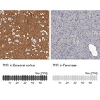 Anti-TNR Antibody