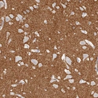 Immunohistochemical staining of human cerebral cortex shows high expression.