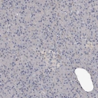 Immunohistochemical staining of human pancreas shows low expression as expected.