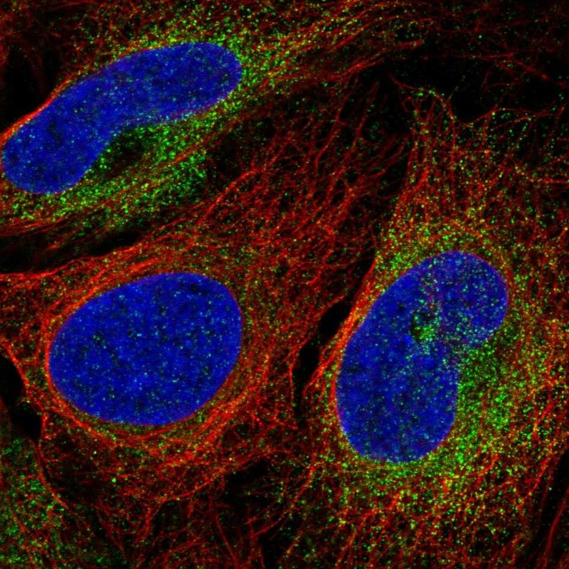 Anti-SCARA3 Antibody