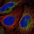 Anti-SCARA3 Antibody