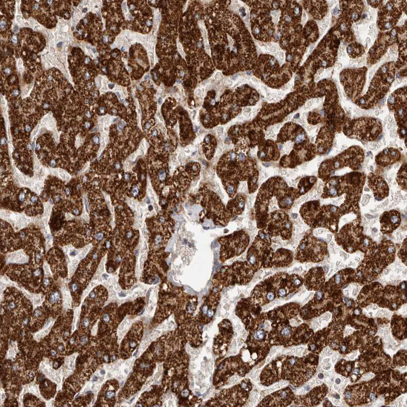 Anti-SLC25A20 Antibody