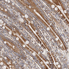 Immunohistochemical staining of human duodenum shows strong cytoplasmic positivity in glandular cells.