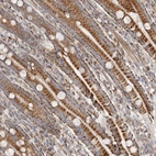 Immunohistochemical staining of human duodenum shows strong cytoplasmic positivity in glandular cells.