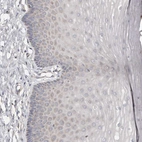 Immunohistochemical staining of human cervix, uterine shows no cytoplasmic positivity in squamous epithelial cells as expected.