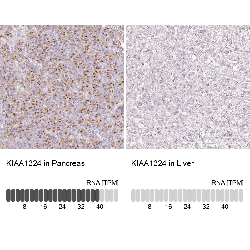 Anti-KIAA1324 Antibody