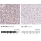 Anti-KIAA1324 Antibody
