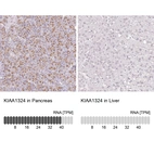 Anti-KIAA1324 Antibody