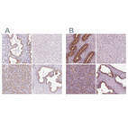 Immunohistochemical staining of human endometrium, liver, pancreas and prostate using Anti-KIAA1324 antibody HPA029869 (A) shows similar protein distribution across tissues to independent antibody HPA070749 (B).