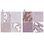 Immunohistochemical staining of human endometrium, liver, pancreas and prostate using Anti-KIAA1324 antibody HPA029869 (A) shows similar protein distribution across tissues to independent antibody HPA070749 (B).