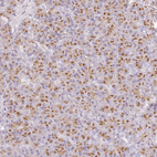 Immunohistochemical staining of human pancreas shows strong granular cytoplasmic positivity in exocrine glandular cells.